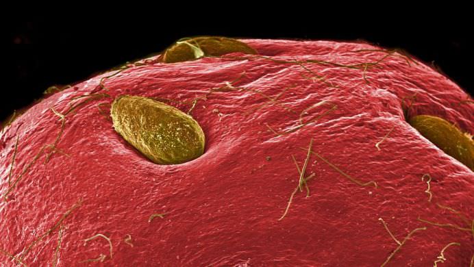 Cele mai populare alimente examinate sub microscop! GALERIE FOTO9
