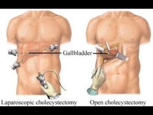 1no10