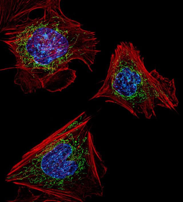 Cele mai frumoase IMAGINI MICROSCOPICE din 20135