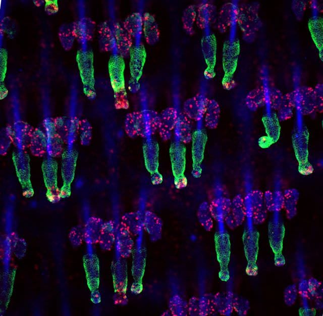 Cele mai frumoase IMAGINI MICROSCOPICE din 20138