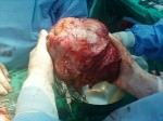 Zece BENEFICII uimitoare ale MIGDALELOR care te vor face sa le mananci ORIUNDE si ORICAND!6