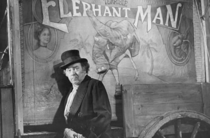 Omul cu CHIP DE ELEFANT! Joseph Merrick este unic in istorie cu BOALA sa! FOTO + VIDEO3