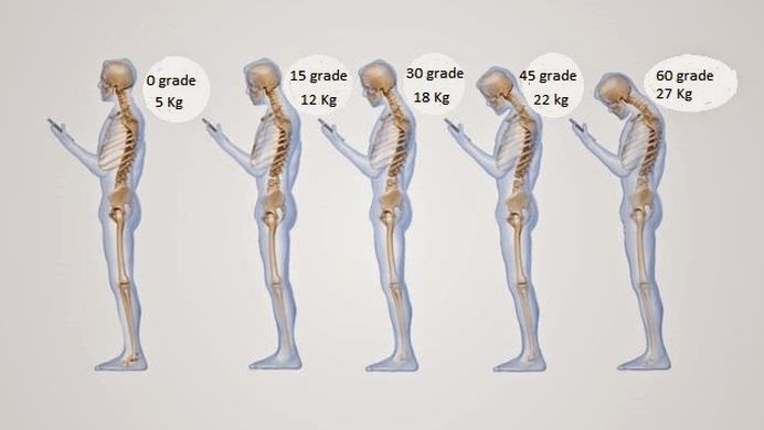 SMARTPHONE-ul te poate DEFORMA! Cum iti strici SANATATEA fara sa-ti dai seama!2